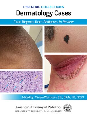 cover image of Pediatric Collections